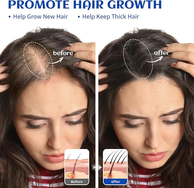HIQILI Rosemary Oil for Hair Care, Diffuser & DIY
