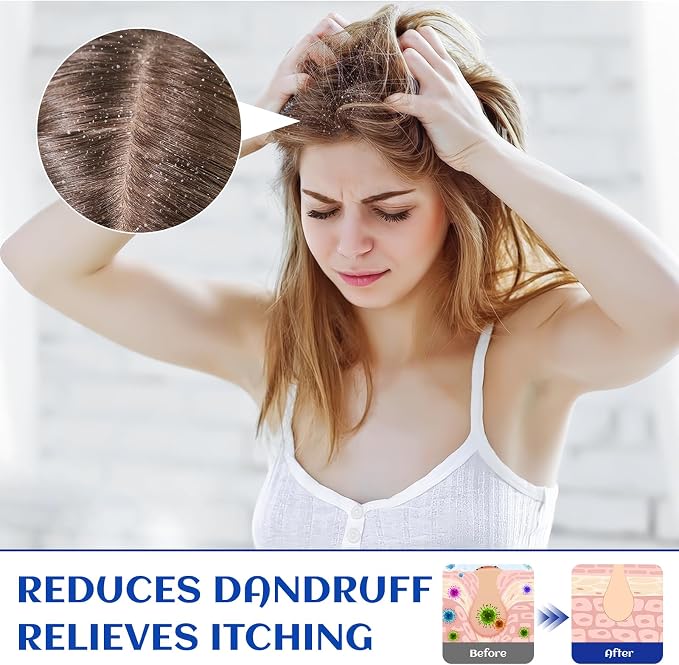 HIQILI Rosemary Oil for Hair Care, Diffuser & DIY